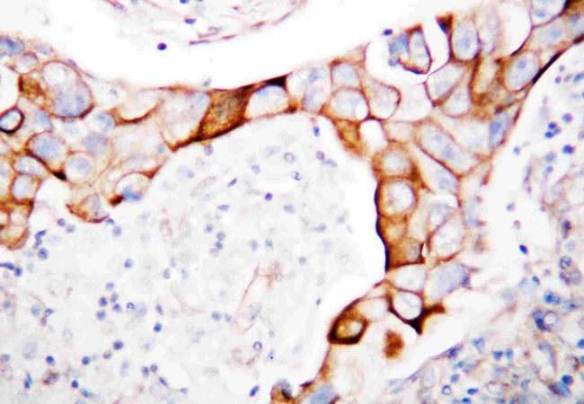 CD18 Antibody in Immunohistochemistry (Paraffin) (IHC (P))