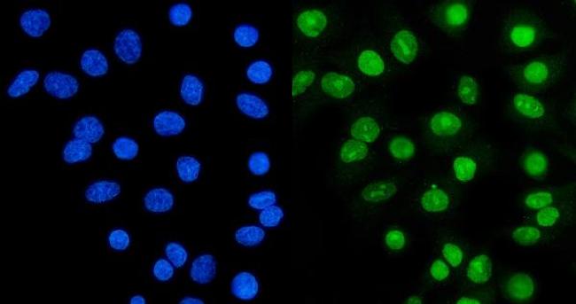 Ku70 Antibody in Immunocytochemistry (ICC/IF)