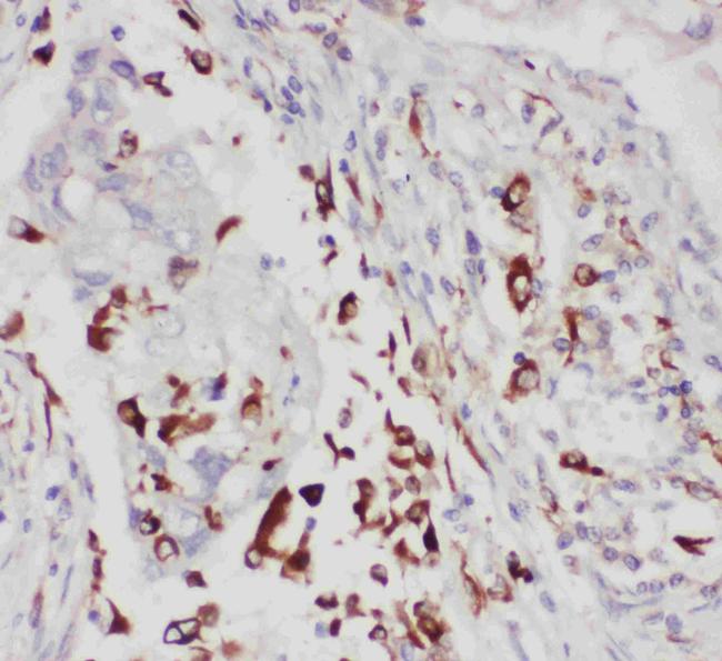 ALOX5 Antibody in Immunohistochemistry (Paraffin) (IHC (P))