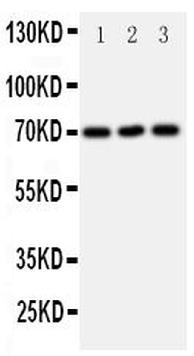 SLC6A4 Antibody in Western Blot (WB)