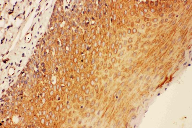 SOCS3 Antibody in Immunohistochemistry (Paraffin) (IHC (P))