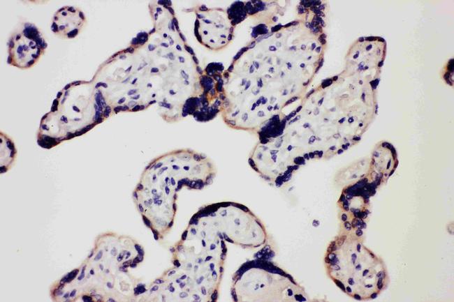 TLR7 Antibody in Immunohistochemistry (Paraffin) (IHC (P))