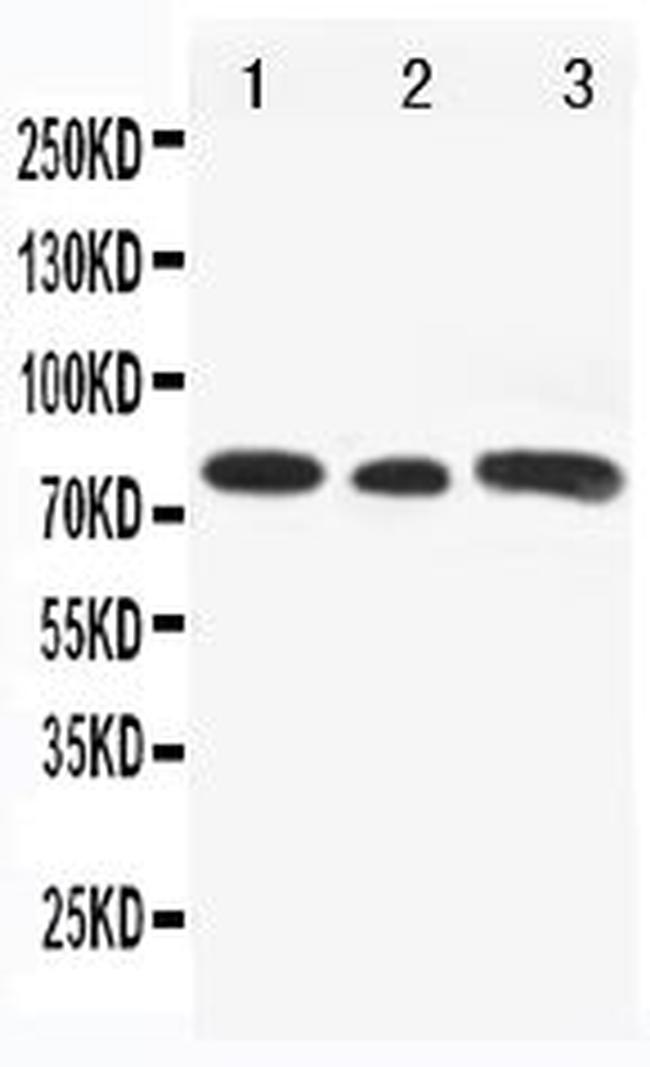 GLI3 Antibody in Western Blot (WB)