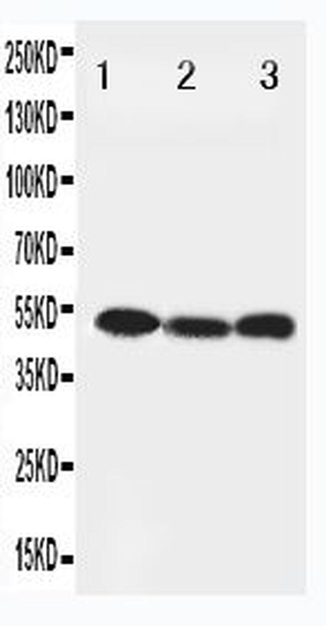 Beclin 1 Antibody in Western Blot (WB)