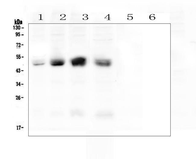 CAR Antibody in Western Blot (WB)