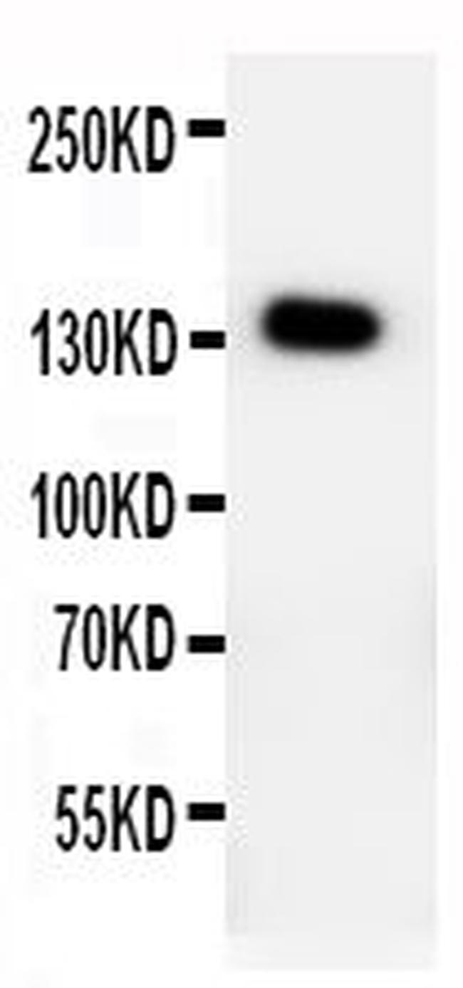 PTCH2 Antibody in Western Blot (WB)