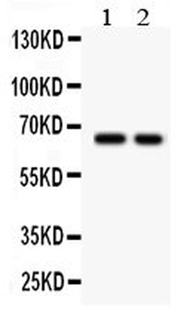 TGFBR2 Antibody in Western Blot (WB)