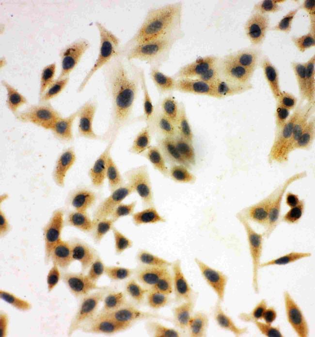 NRG1 Antibody in Immunocytochemistry (ICC/IF)