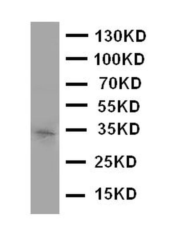 Aquaporin 10 Antibody in Western Blot (WB)