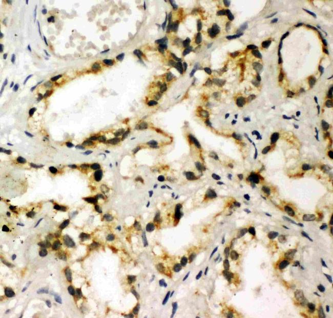 TBK1 Antibody in Immunohistochemistry (Paraffin) (IHC (P))