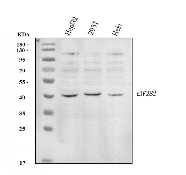 eIF2 beta Antibody in Western Blot (WB)