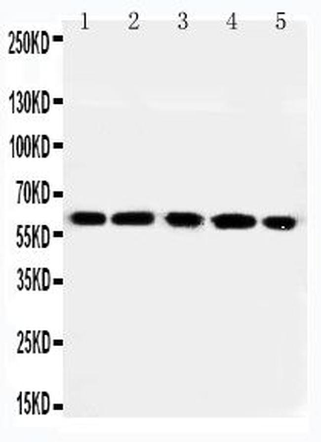 RGS14 Antibody in Western Blot (WB)