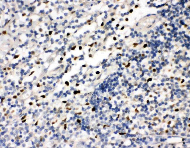 FLI1 Antibody in Immunohistochemistry (Paraffin) (IHC (P))