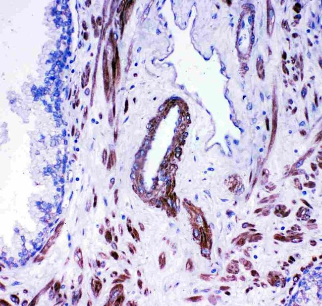 ACE Antibody in Immunohistochemistry (Paraffin) (IHC (P))