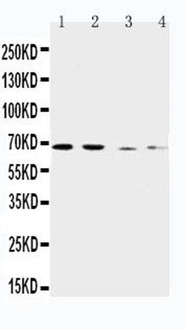 SLC7A1 Antibody in Western Blot (WB)