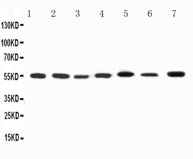 KV1.1 (KCNA1) Antibody in Western Blot (WB)