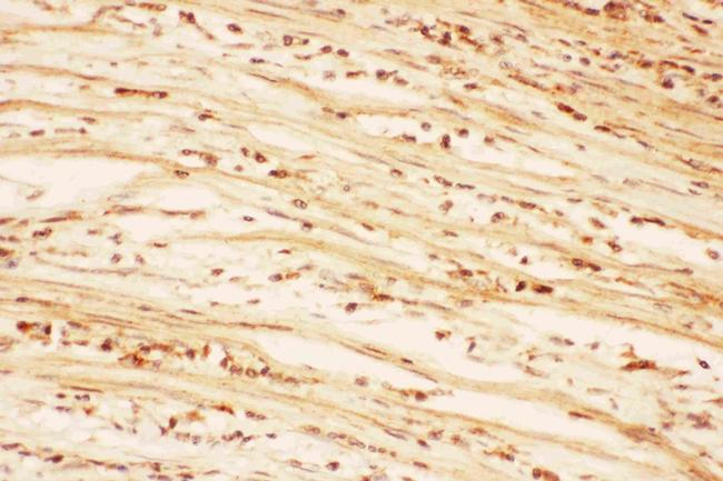 AKT2 Antibody in Immunohistochemistry (Paraffin) (IHC (P))