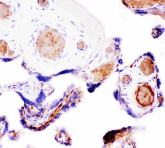 WNT5A Antibody in Immunohistochemistry (Paraffin) (IHC (P))