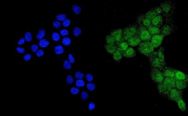 Ubiquitin B Antibody in Immunocytochemistry (ICC/IF)