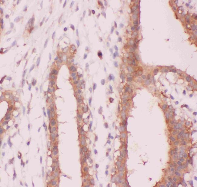 NFkB p52/p100 Antibody in Immunohistochemistry (Paraffin) (IHC (P))