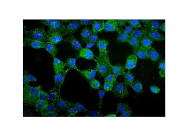 gamma Catenin Antibody in Immunocytochemistry (ICC/IF)