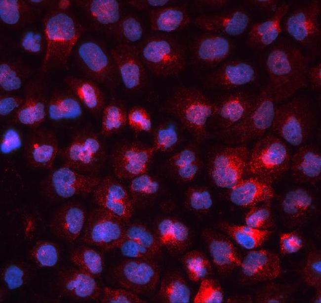 Transferrin Receptor Antibody in Immunocytochemistry (ICC/IF)