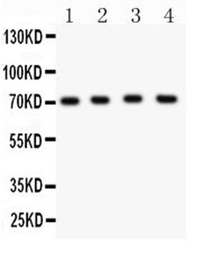 KV4.1 (KCND1) Antibody in Western Blot (WB)