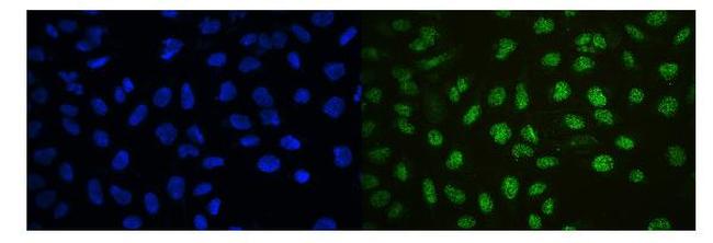 Ku70 Antibody in Immunocytochemistry (ICC/IF)