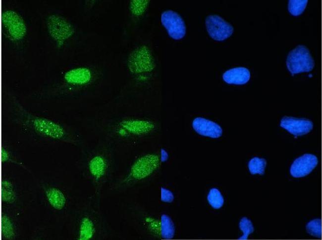 CDK1 Antibody in Immunocytochemistry (ICC/IF)