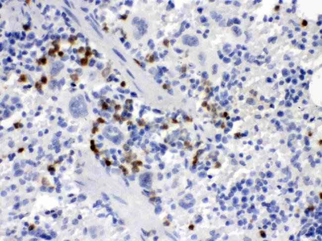 M-CSF Antibody in Immunohistochemistry (Paraffin) (IHC (P))