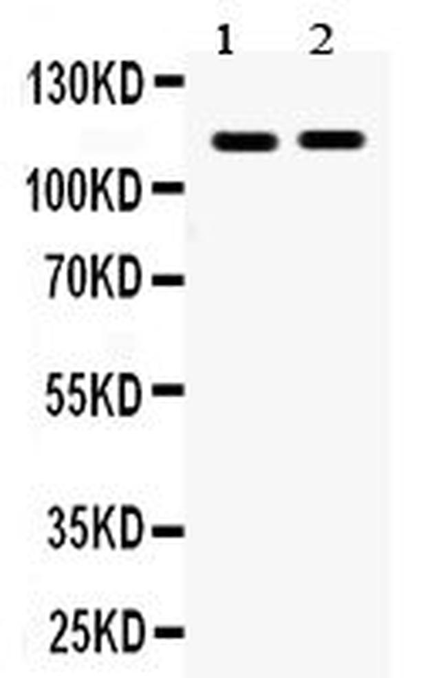 EphA5 Antibody in Western Blot (WB)