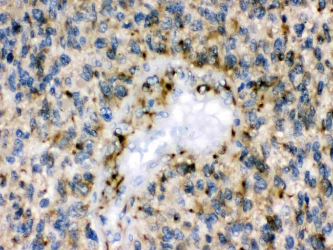 EphB1 Antibody in Immunohistochemistry (Paraffin) (IHC (P))