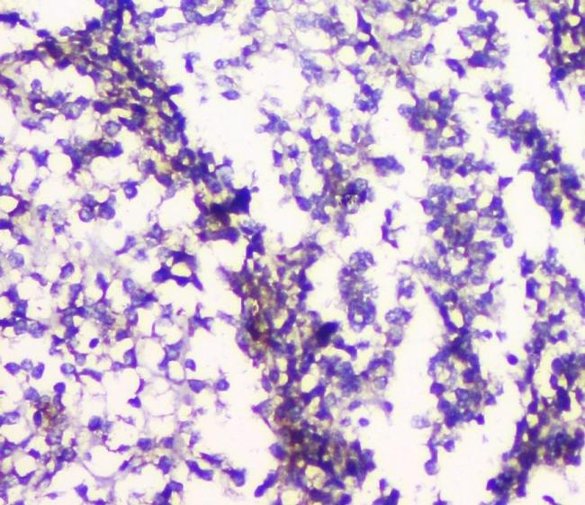 HTR2A Antibody in Immunohistochemistry (Paraffin) (IHC (P))