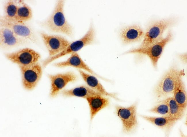 IDH1 Antibody in Immunocytochemistry (ICC/IF)