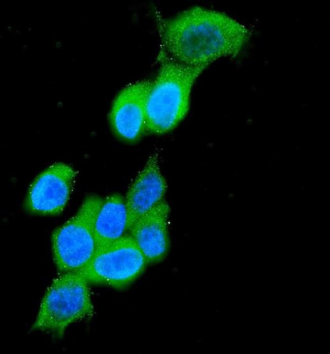 Cytokeratin 19 Antibody in Immunocytochemistry (ICC/IF)