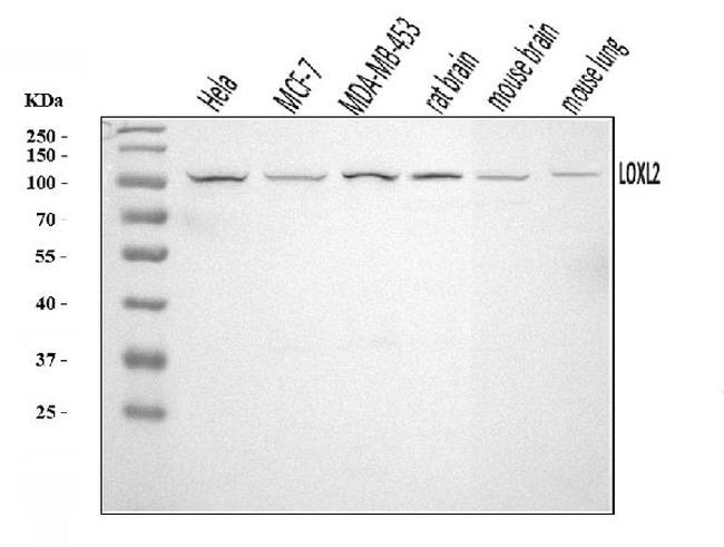 LOXL2 Antibody in Western Blot (WB)