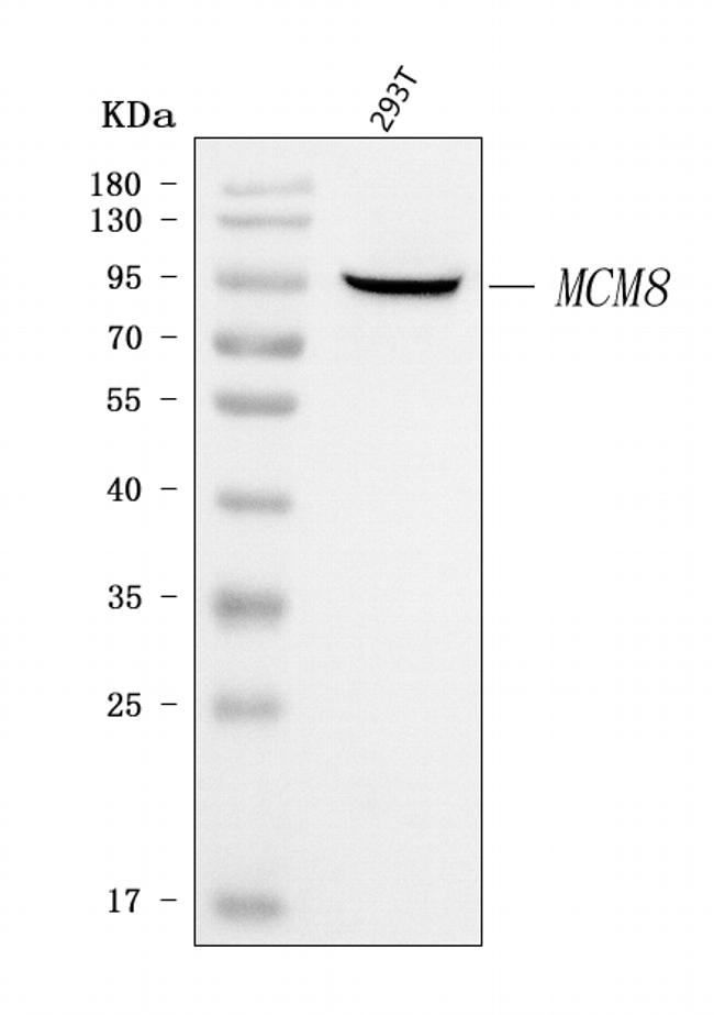 MCM8 Antibody in Western Blot (WB)