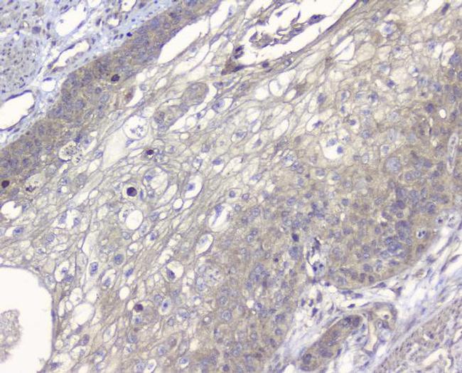 Alix Antibody in Immunohistochemistry (Paraffin) (IHC (P))