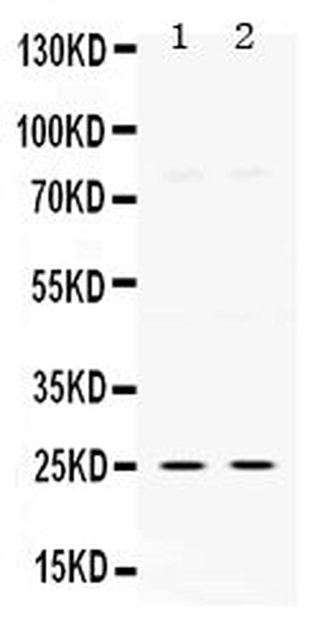 TK1 Antibody in Western Blot (WB)