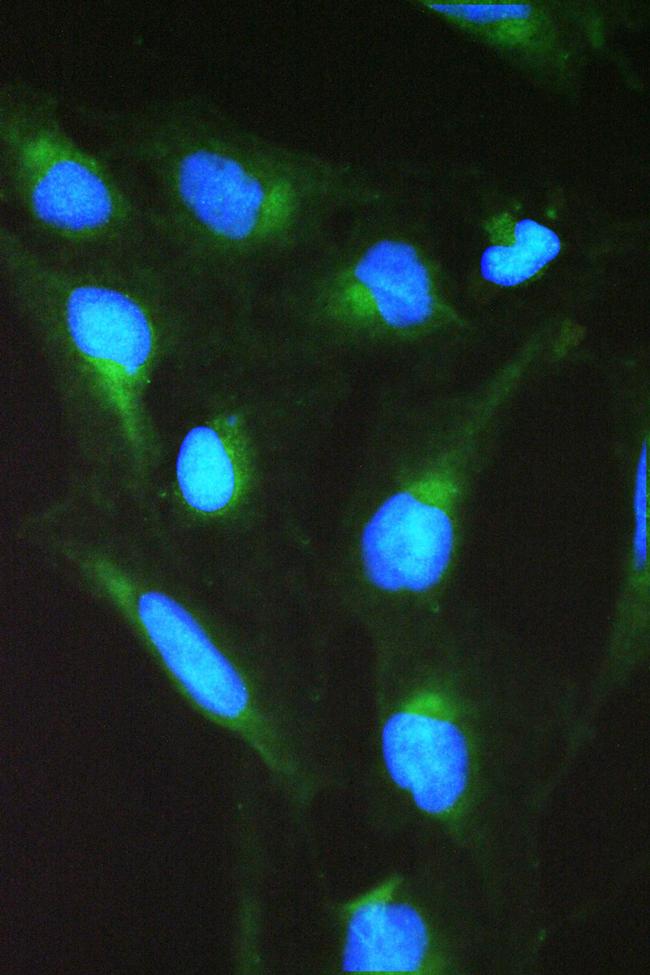 SPTLC1 Antibody in Immunocytochemistry (ICC/IF)