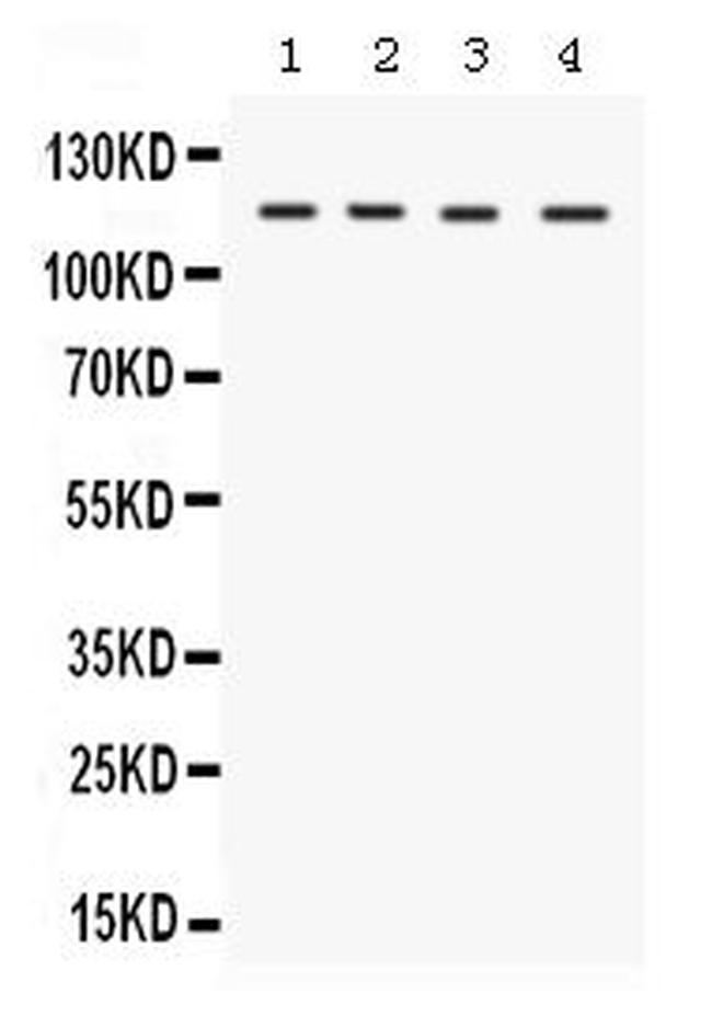 UBE1 Antibody in Western Blot (WB)