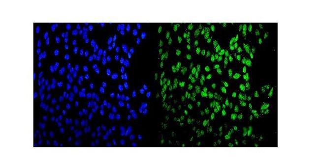 MEF2A Antibody in Immunocytochemistry (ICC/IF)