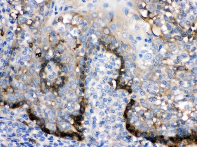 Zap-70 Antibody in Immunohistochemistry (Paraffin) (IHC (P))