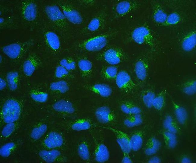 RPSA Antibody in Immunocytochemistry (ICC/IF)