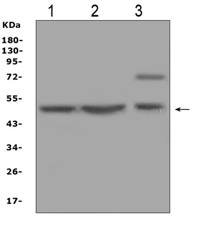 AP2M1 Antibody in Western Blot (WB)