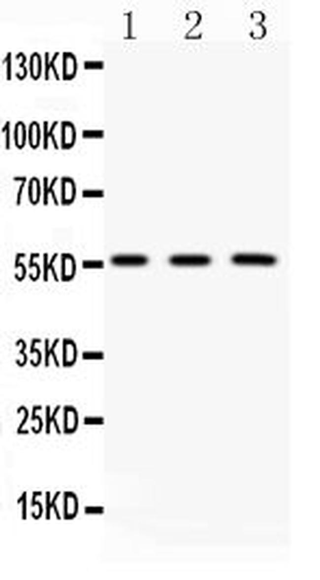 FIBB Antibody in Western Blot (WB)