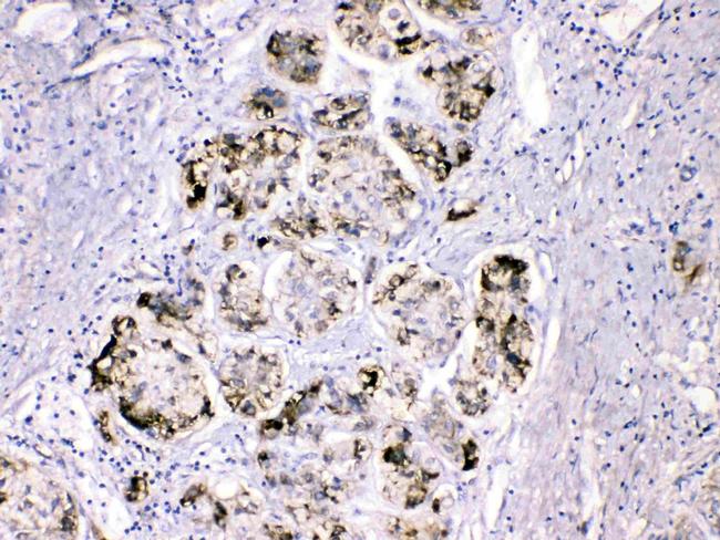 Fibrinogen gamma Antibody in Immunohistochemistry (Paraffin) (IHC (P))