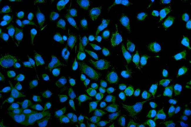 KCNQ1 Antibody in Immunocytochemistry (ICC/IF)