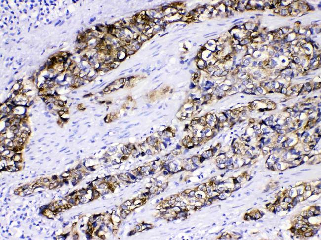 Cytokeratin 5 Antibody in Immunohistochemistry (Paraffin) (IHC (P))