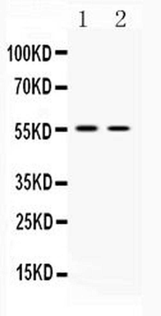 VAChT Antibody in Western Blot (WB)